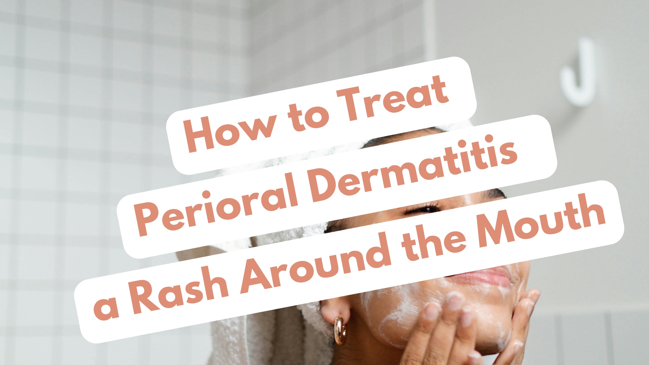 how to treat perioral dermatitis