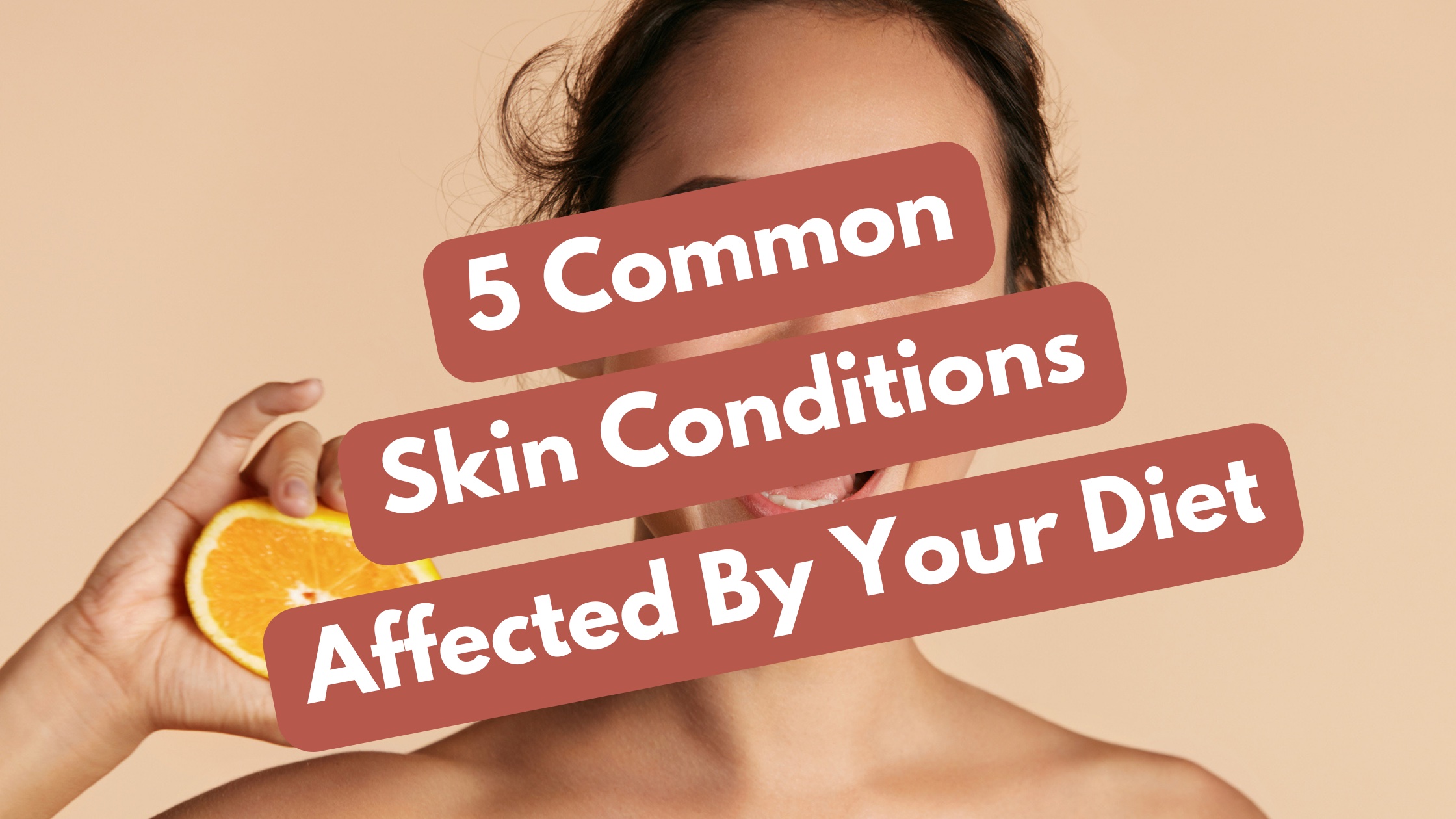 skin conditions affected by diet